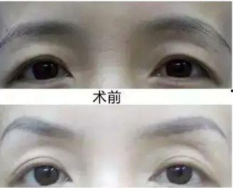 切眉视频,跟随视频教程，重塑眉型新篇章