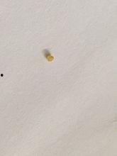 鼻子毛孔堵塞图片大全,图片解析与防治攻略