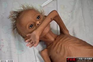 皮包骨瘦人图片女,探寻健康与美的平衡之路