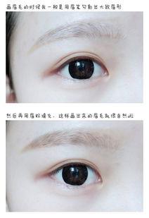 眼睛上火肿图片,症状解析与应对策略