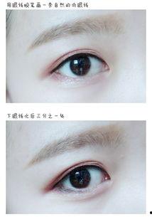 眼睛上火肿图片,症状解析与应对策略